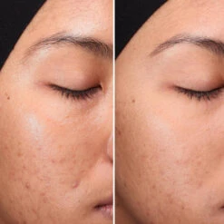 Medik8 Press & Clear -Cosmetics Store 13903592 2054992828269130