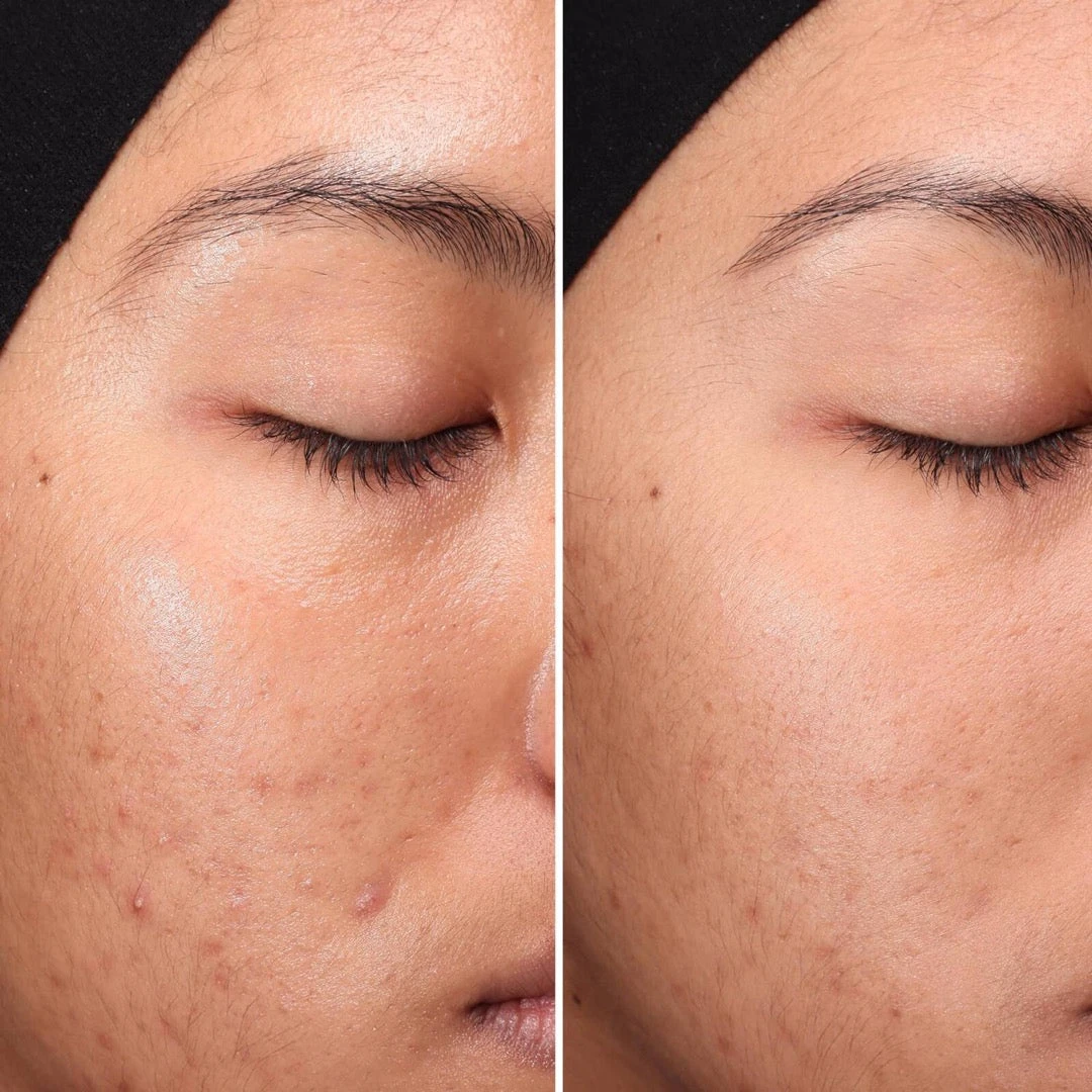 Medik8 Press & Clear Refill 8 Medik8 Press & Clear Refill - Image 6