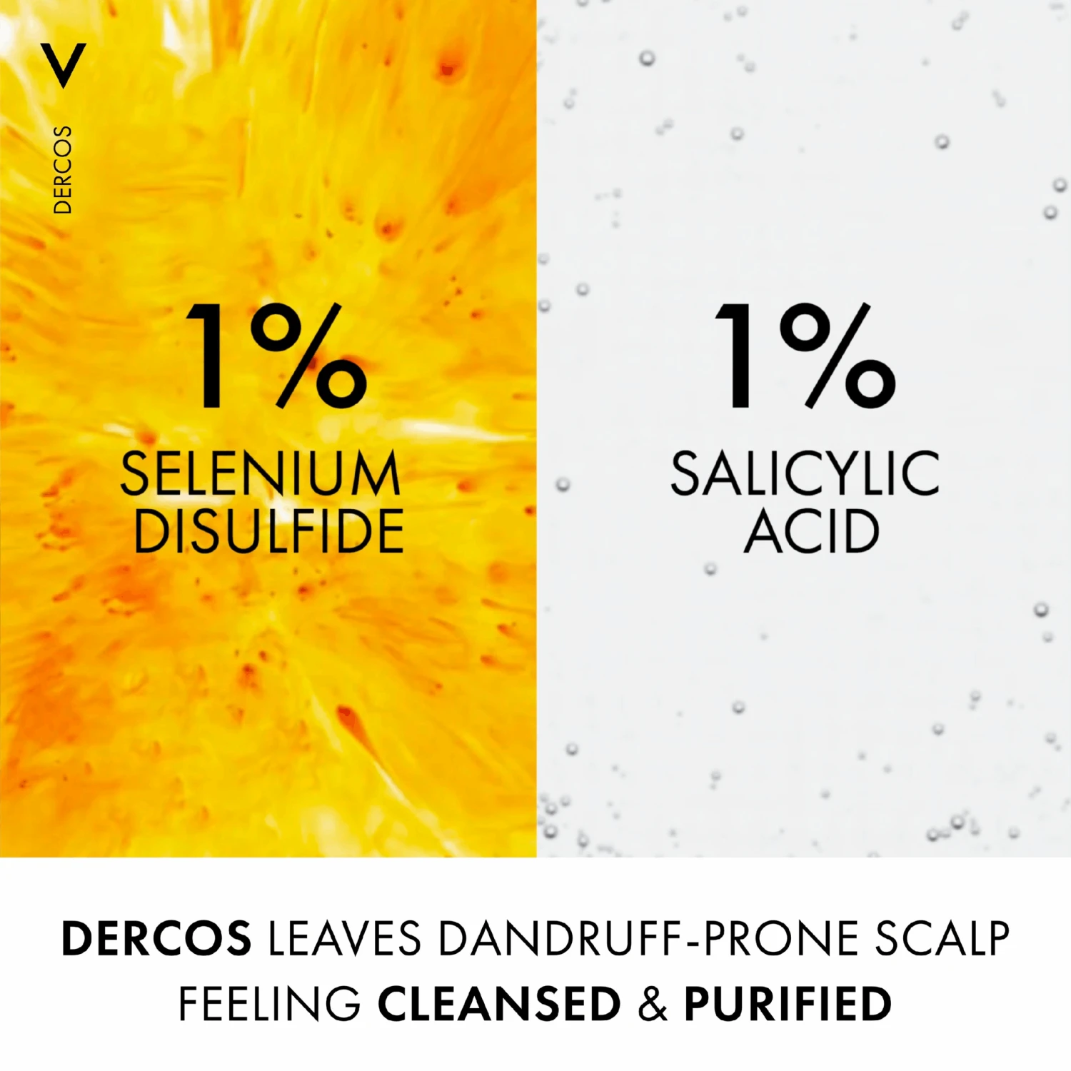 Vichy Dercos Anti-Dandruff Shampoo For Sensitive Scalp 200ml 7 Vichy Dercos Anti-Dandruff Shampoo For Sensitive Scalp 200ml - Image 5