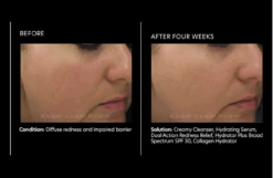 PCA Dual Action Redness Relief -Cosmetics Store Dualactionrednessresults2 1500x1500 2b00444b 435d 4281 9bfd 861fc3648042