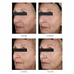 IS Clinical Youth Eye Complex 7 IS Clinical Youth Eye Complex -Cosmetics Store OnlineListingImage 5 1024x1024 d80f8de6 6f8b 475b a393 2d2e6ebe8cfe