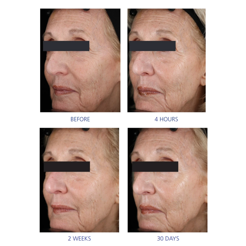 IS Clinical Youth Eye Complex 5 IS Clinical Youth Eye Complex - Image 3