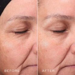 Medik8 Press & Glow Refill -Cosmetics Store Press Glow Before After