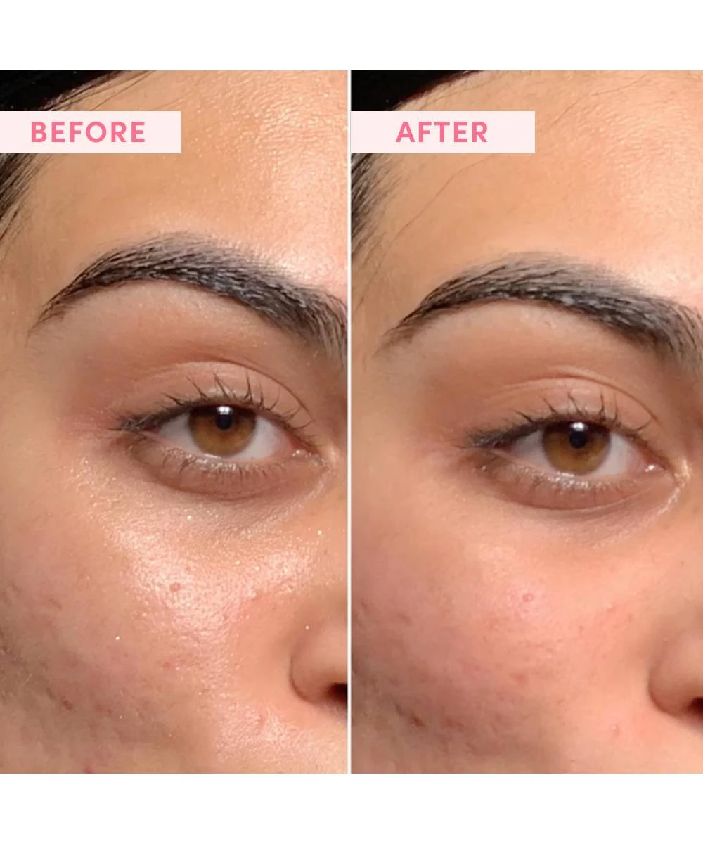 Sand & Sky Micro-Exfoliating Face Scrub 5 Sand & Sky Micro-Exfoliating Face Scrub - Image 3