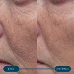 Elemis Pro-Collagen Marine Cream SPF 30 17 Elemis Pro-Collagen Marine Cream SPF 30 -Cosmetics Store mcb a 2000x2000 ded64fdb d41e 4b74 9213 1f20aeb81497