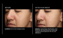 PCA Skin Pore Minimizer Mattifying Gel -Cosmetics Store poreminizingbenefits 1500x1500 3ca89d8a f7e3 4e53 b2f8 4f195b3cc61c