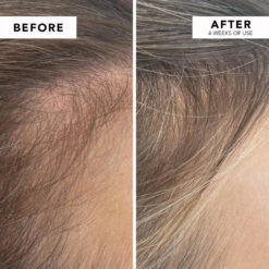 WE ARE PARADOXX Growth Advanced Scalp Serum 50ml -Cosmetics Store serum3 min